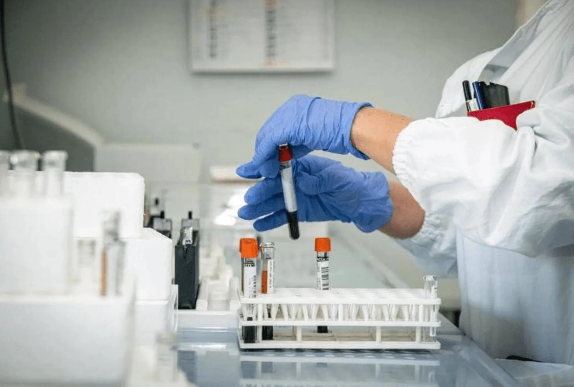 Novo teste de sangue identifica alterações estruturais em proteínas e promete avanço no diagnóstico precoce do Alzheimer