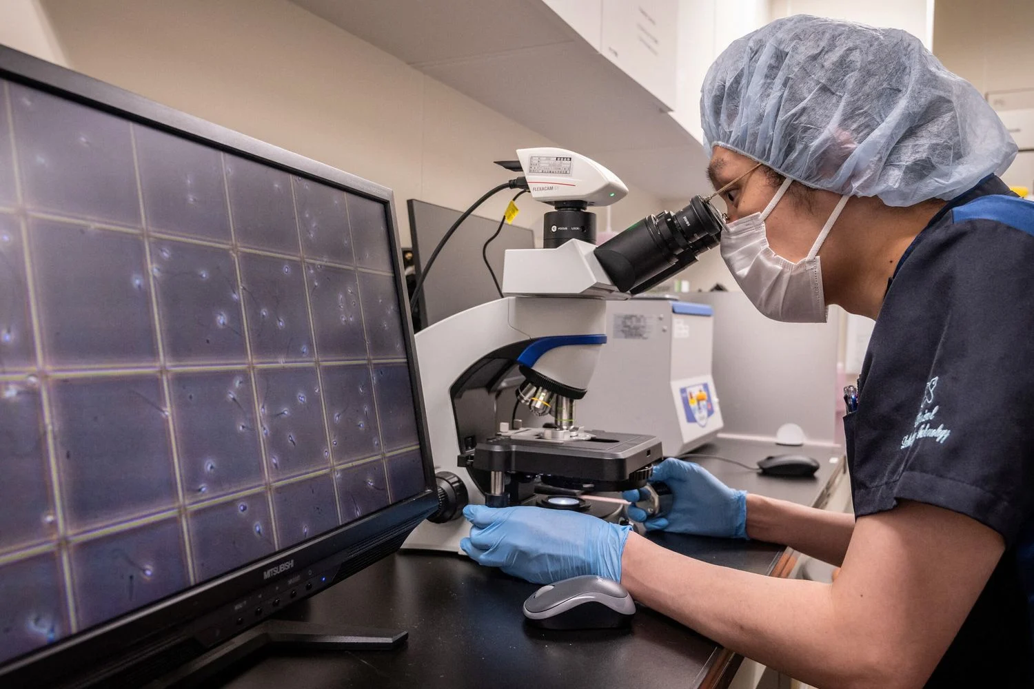 Exame de sangue simples pode prever a doença de Crohn anos antes dos sintomas