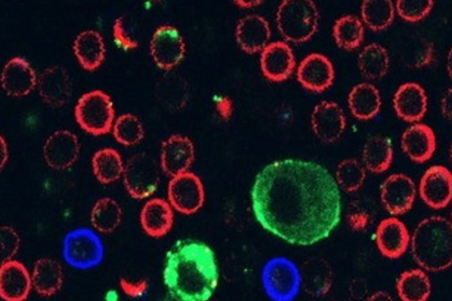 Melanoma usa vesículas para paralisar linfócitos T, revela estudo da Tel Aviv