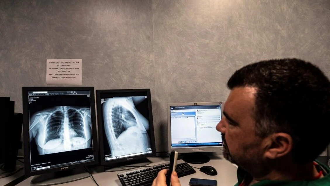 Itália adota IA para decidir quais mamografias terão dupla leitura no rastreamento do câncer de mama