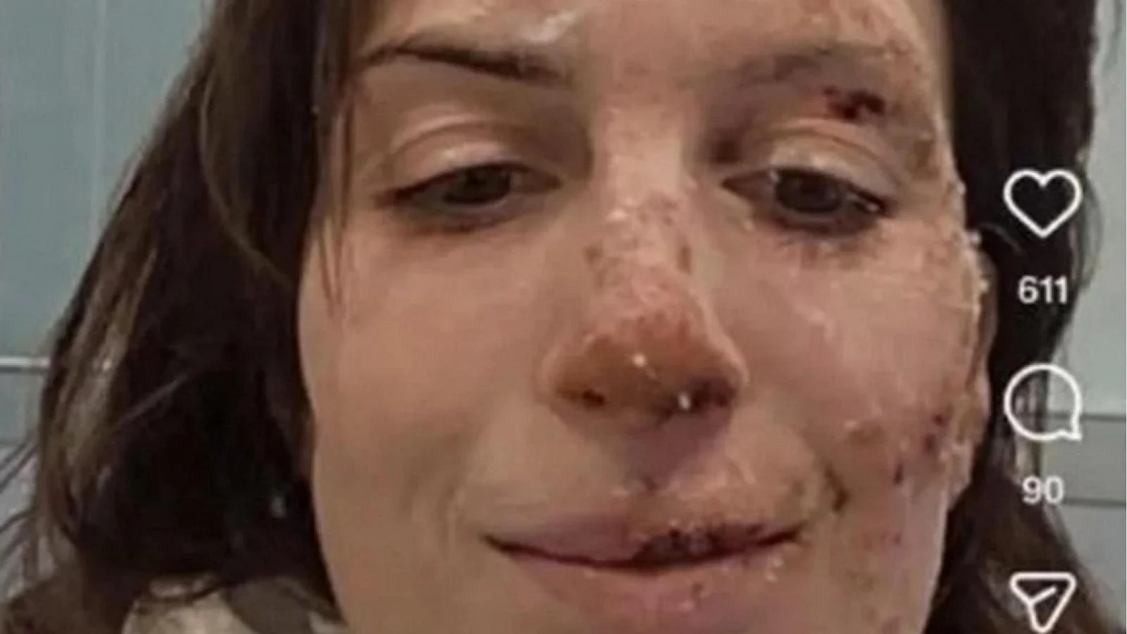 Eleonora Palmieri mostra rosto queimado nas redes: ‘Nunca deixem de honrar a vida’