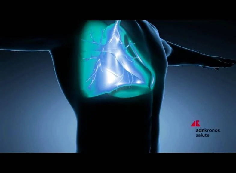 Bronquiectasias: a doença pulmonar crônica muitas vezes negligenciada ganha foco em Milão